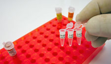 PCR XMRV and CFS