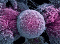 4690-XMRVprostate-cancer-cells.gif