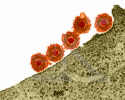 Herpesviruses: the cause of ME/CFS?